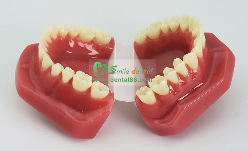 B6 Orthodontic Model